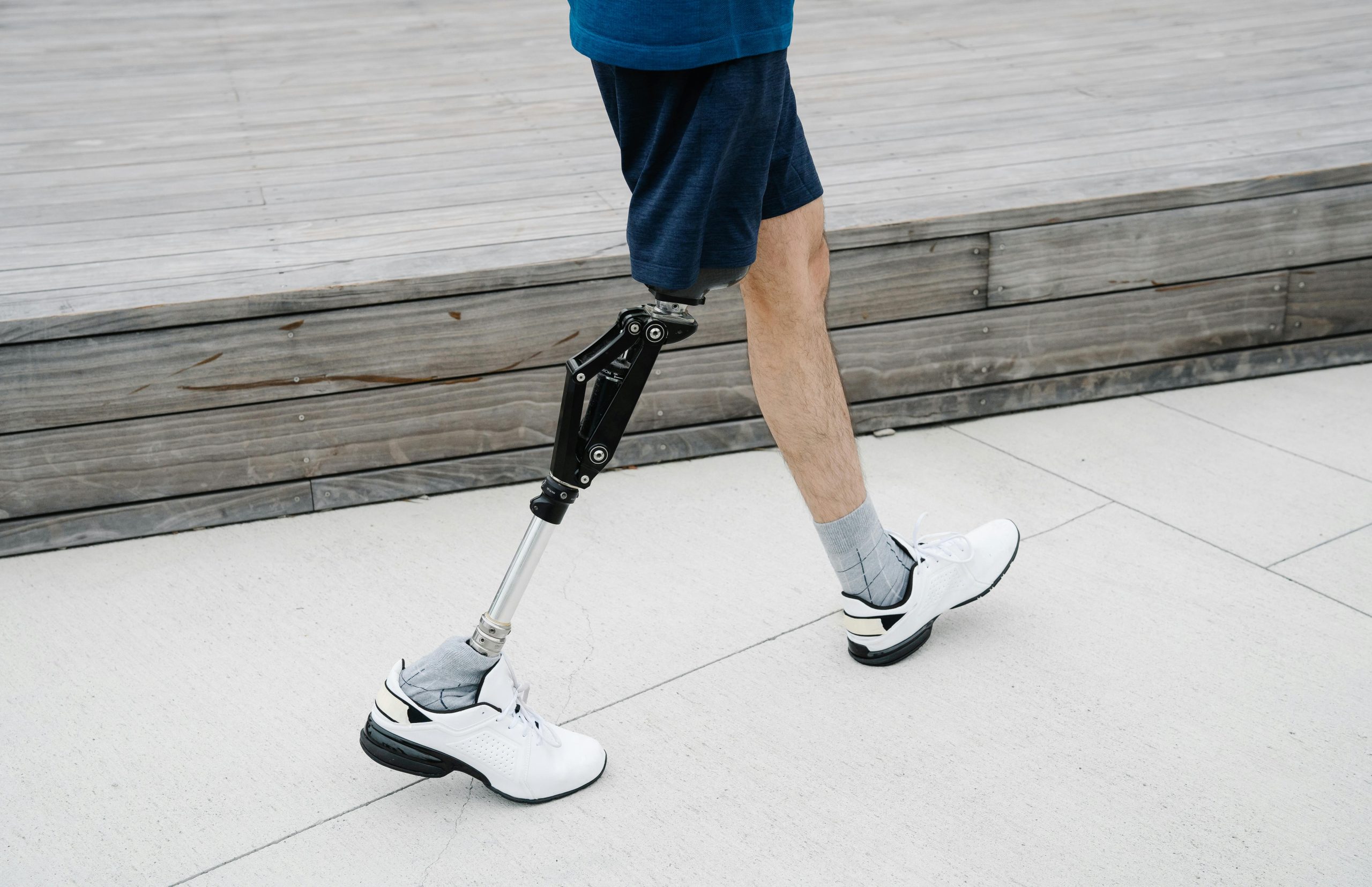 Close-up of an adult walking with a prosthetic leg, embracing mobility outdoors.